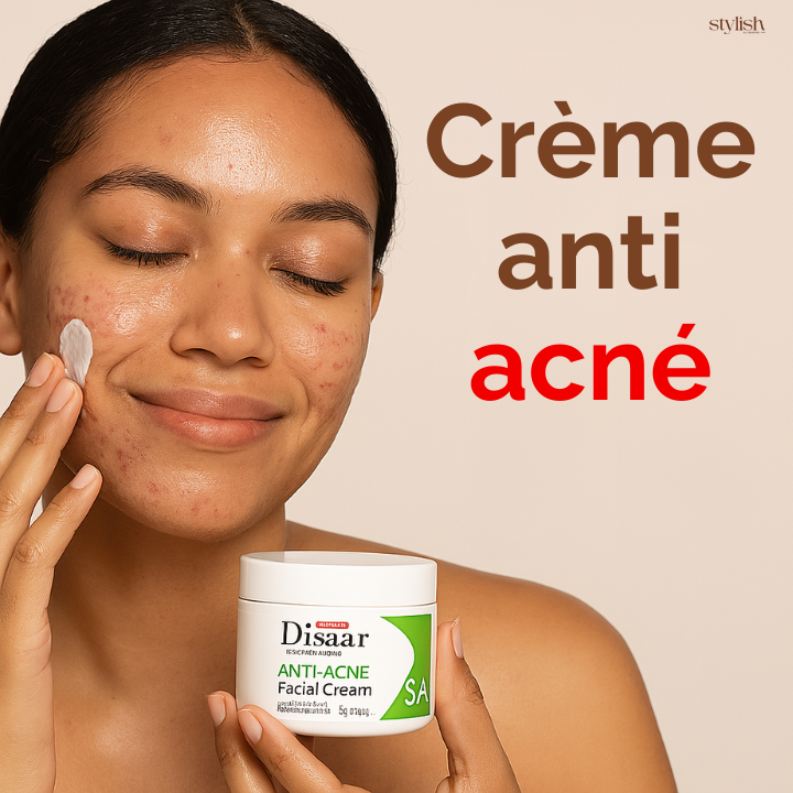 Crème Anti Acné ( anti boutons pour une peau éclatante )