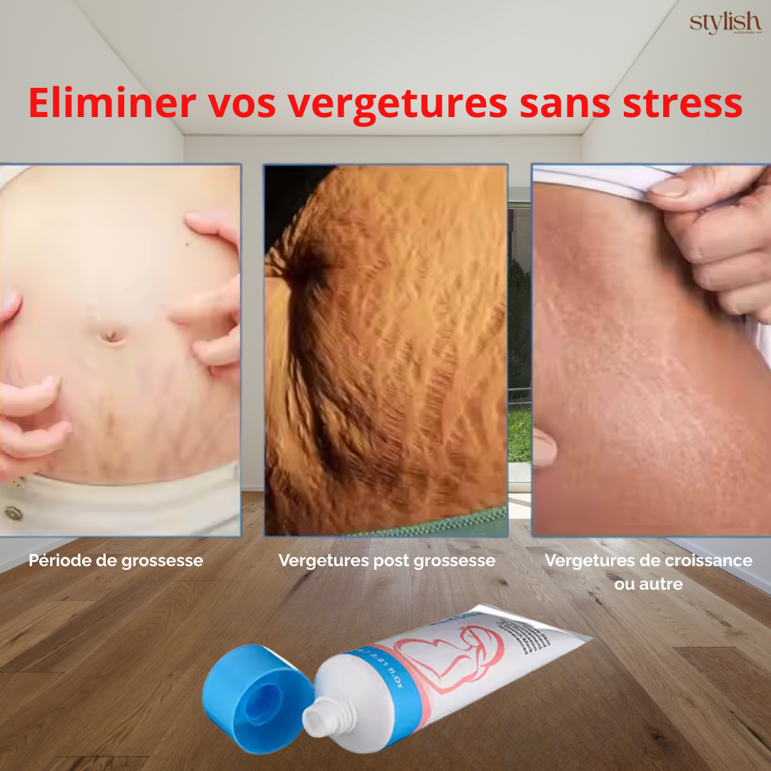 Crème anti-vergetures et anti cicatrices