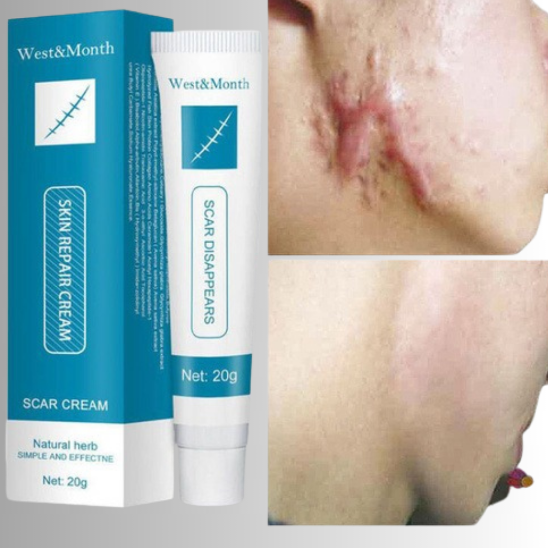 Crème réparatrice pour cicatrices